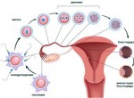 ЭКО в естественном цикле