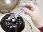 Осложнения после искусственной инсеминации